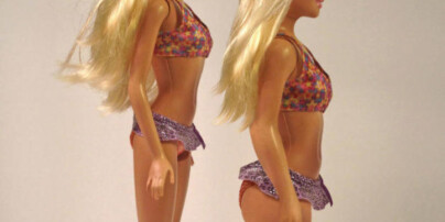 image: Barbie har fått strekkmerker, kviser og arr